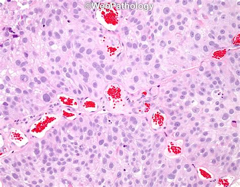 webpathology|WebPathology.